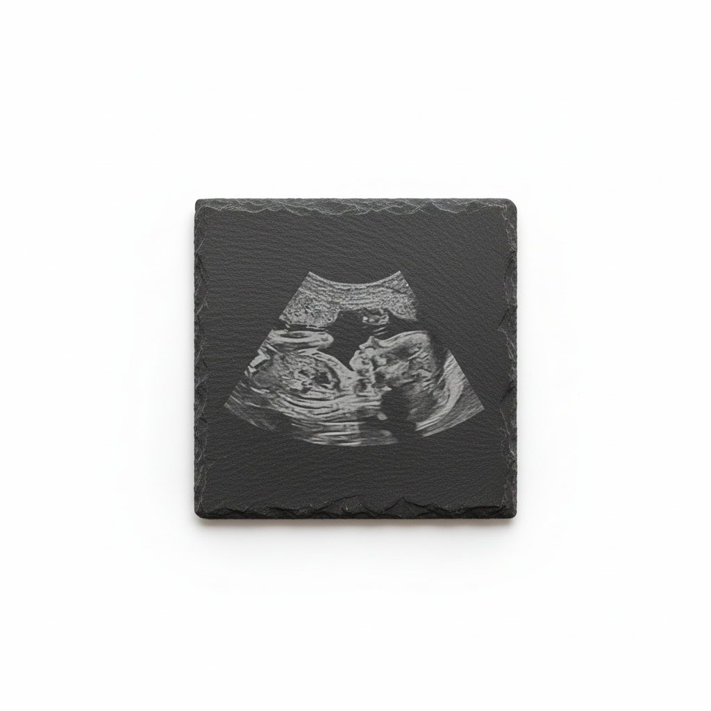 Slate - Baby Photo Only