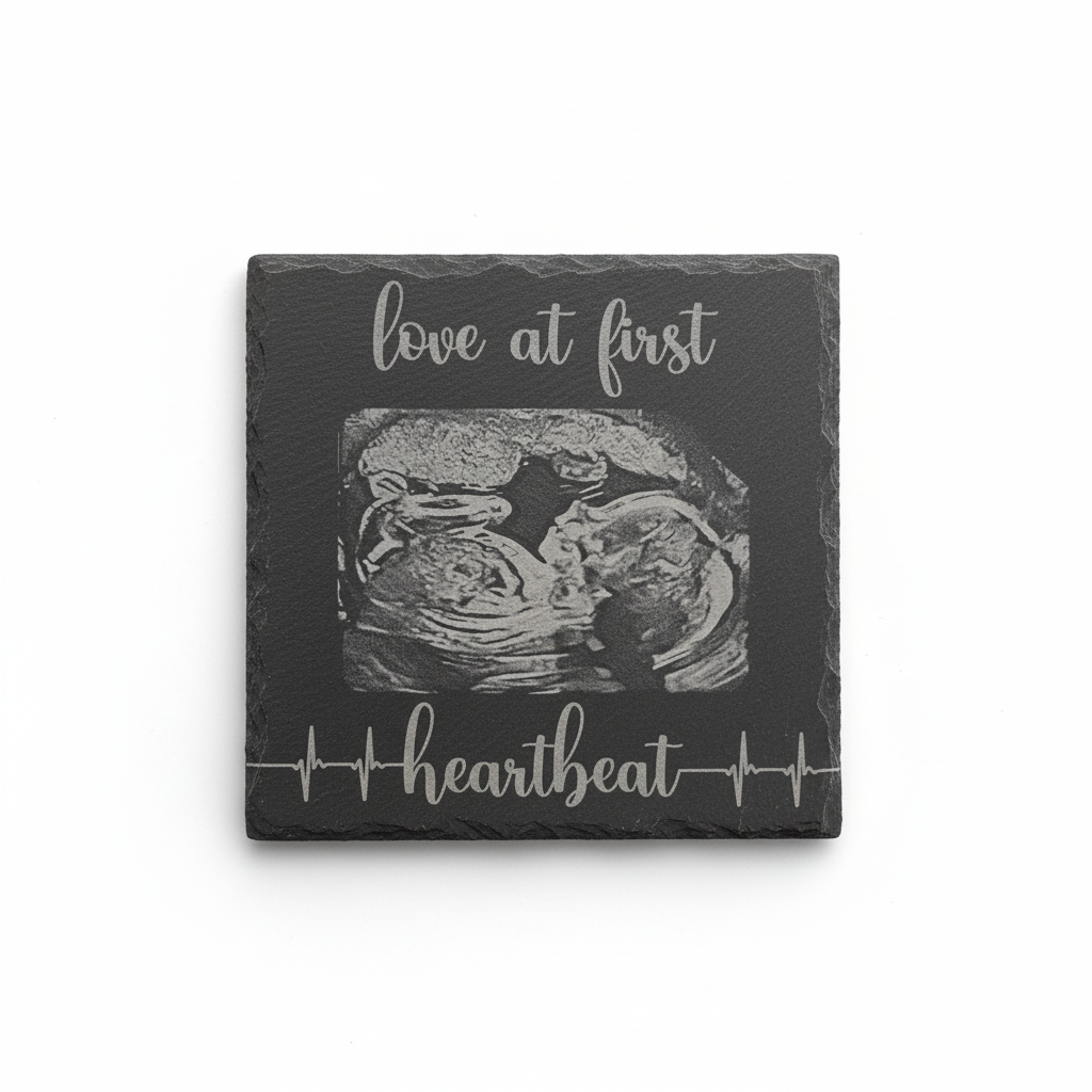 Slate - Love at First Heartbeat